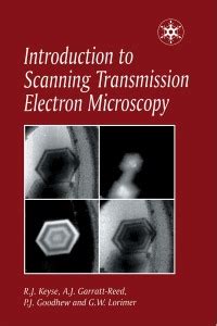 Progress in Transmission Electron Microscopy 1 1st Edition Kindle Editon